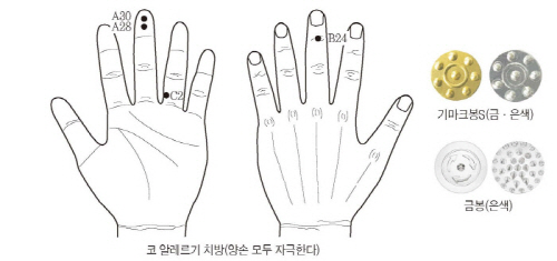 고려수지침요법학회 이미지