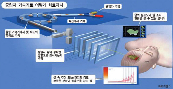 부산시 꿈의 암 치료기 구축사업 청신호