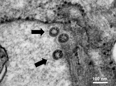 [그림1] 전자현미경으로 본 신종 코로나바이러스