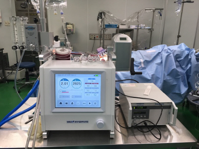 [사진] 공동연구팀이 개발한 에크모(ECMO) 장비