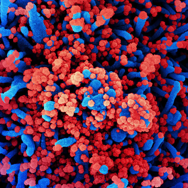 US-HEALTH-VIRUS <YONHAP NO-1080> (AFP)