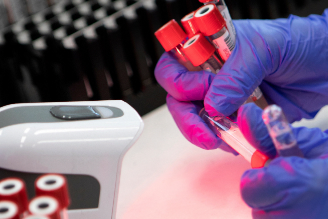 AUSTRIA-HEALTH-VIRUS-TESTING