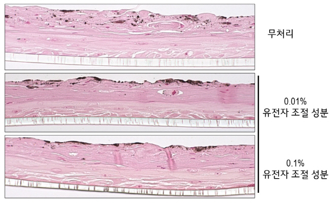 사진2_LG생활건강_유전자 조절 소재의 멜라닌 색소 감소 효능