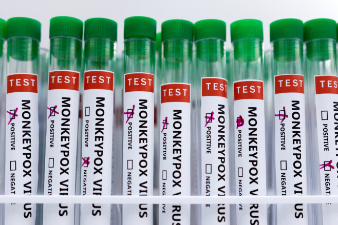 HEALTH-MONKEYPOX/