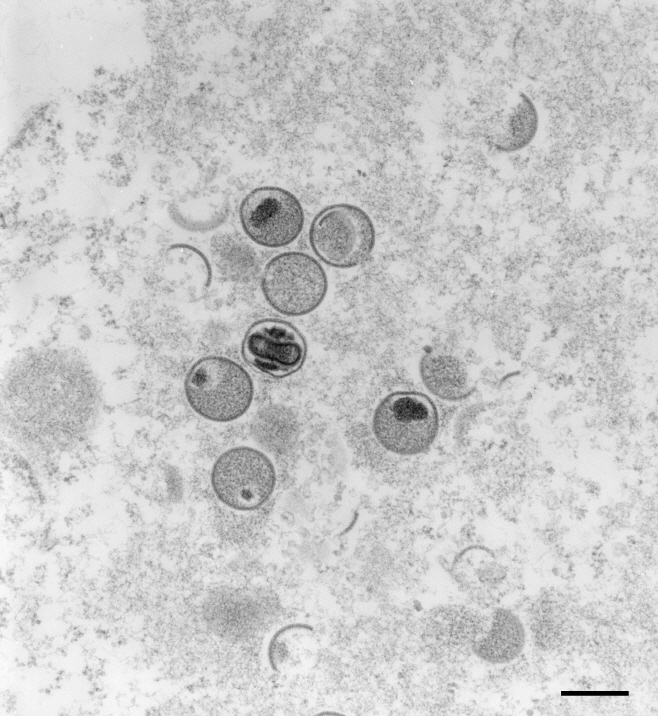 전자현미경에 포착된 원숭이 두창 바이러스