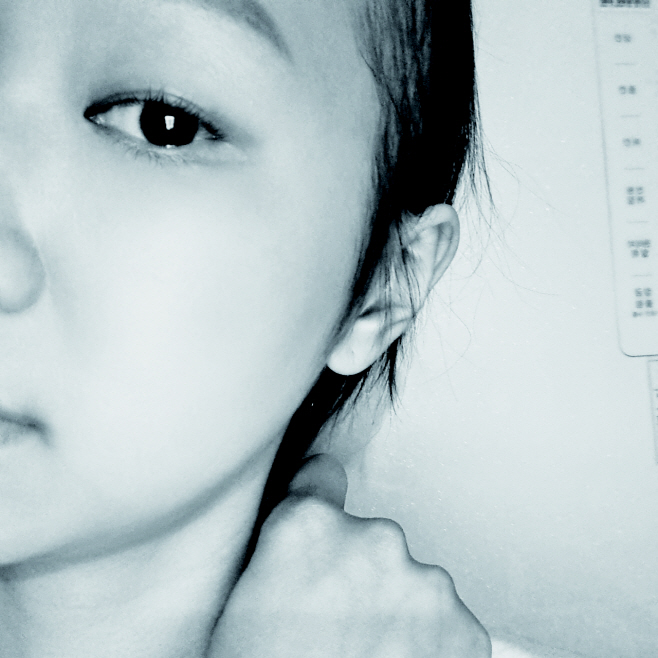 ㅇ