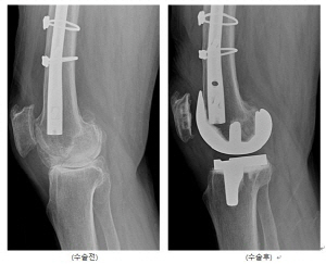 KakaoTalk_20220825_105904090