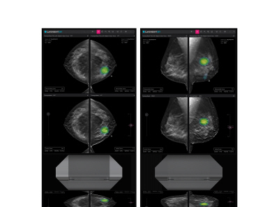 Lunit INSIGHT DBT