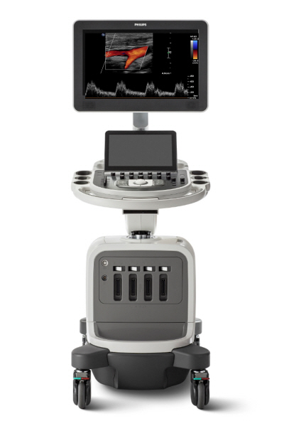 필립스 범용 초음파 시스템 어피니티 70(Affiniti 70)