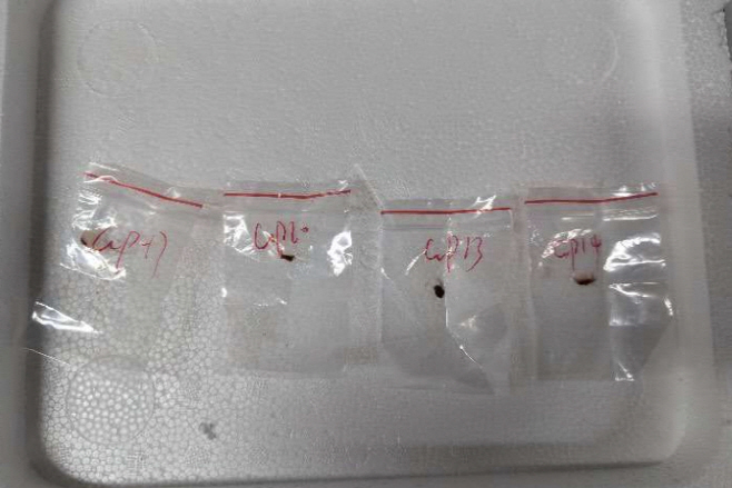 US Dangerous Fungus <YONHAP NO-0885> (AP)
