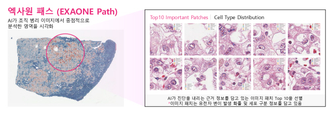 [이미지] 엑사원 패스는 전체 슬라이드 이미지(WSI)에서 암과 관련된 유전자 변이를 예측할 수 있다