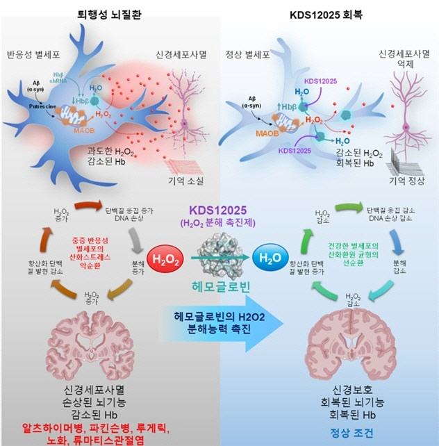 헤모글로빈
