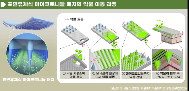 [그림] 표면유체식 마이크로니들 패치의 약물 이동 과정
