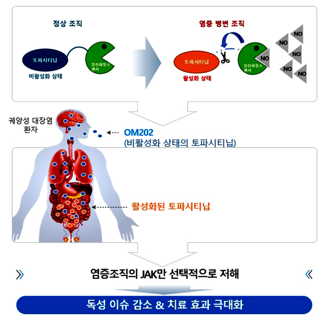 [붙임]궤양성 대장염 치료제 원스톱 개발 지원